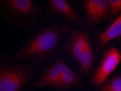 Immunocytochemistry/ Immunofluorescence: MARCKS [p Ser162] Antibody - BSA Free [NBP3-05423]